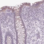Merck Anti-NHSL2 antibody produced in rabbit