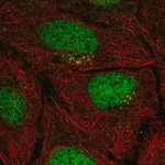 Merck Anti-PPP1R1C antibody produced in rabbit