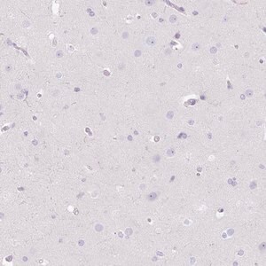 Merck Anti-DCAF17 antibody produced in rabbit