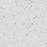 Merck Anti-DCAF17 antibody produced in rabbit