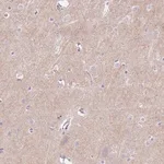 Merck Anti-PRRT1 antibody produced in rabbit