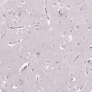 Merck Anti-TMEM151B antibody produced in rabbit