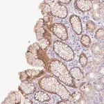 Merck Anti-SLC25A40 antibody produced in rabbit