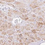 Merck Anti-ITPK1 antibody produced in rabbit