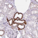 Merck Anti-NHLH2 antibody produced in rabbit
