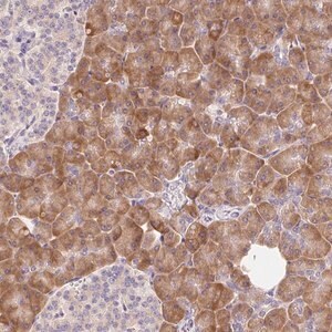 Merck Anti-RPL18A antibody produced in rabbit