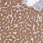 Merck Anti-EML5 antibody produced in rabbit