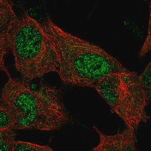 Merck Anti-EPM2A antibody produced in rabbit