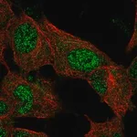 Merck Anti-EPM2A antibody produced in rabbit