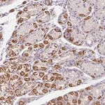 Merck Anti-EPN3 antibody produced in rabbit