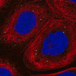 Merck Anti-ADAM19 antibody produced in rabbit