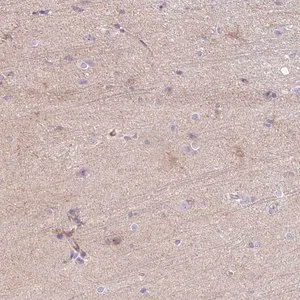 Merck Anti-C2CD4C antibody produced in rabbit