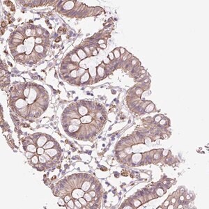 Merck Anti-OR13D1 antibody produced in rabbit