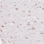 Merck Anti-GPR45 antibody produced in rabbit