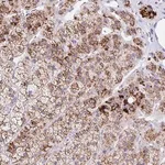 Merck Anti-ANKRD9 antibody produced in rabbit