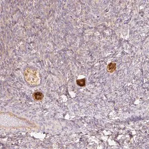 Merck Anti-NLRP5 antibody produced in rabbit