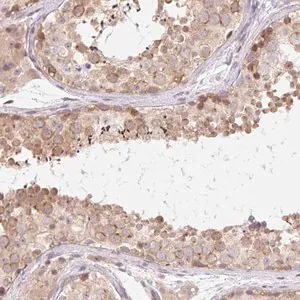 Merck Anti-TBPL2 antibody produced in rabbit
