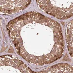Merck Anti-MMS19 antibody produced in rabbit