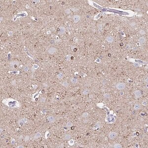 Merck Anti-UGT3A1 antibody produced in rabbit