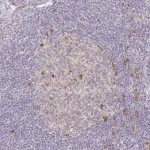 Merck Anti-DERL2 antibody produced in rabbit