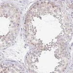 Merck Anti-PROSER3 antibody produced in rabbit