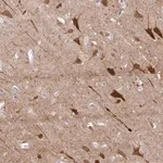 Merck Anti-OR4N4 antibody produced in rabbit