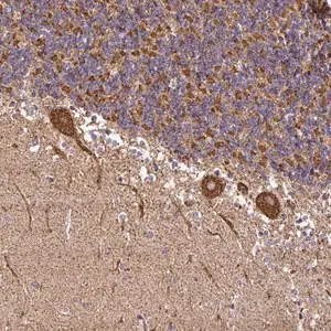 Merck Anti-ANKRD33B antibody produced in rabbit