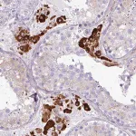 Merck Anti-SLC38A1 antibody produced in rabbit