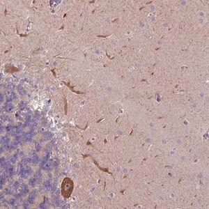 Merck Anti-L3MBTL3 antibody produced in rabbit