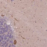 Merck Anti-L3MBTL3 antibody produced in rabbit