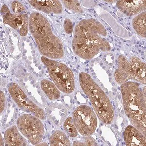 Merck Anti-MDS2 antibody produced in rabbit