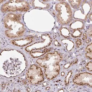 Merck Anti-CCDC85B antibody produced in rabbit
