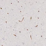 Merck Anti-KIAA2022 antibody produced in rabbit