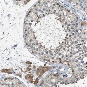 Merck Anti-NANOS2 antibody produced in rabbit