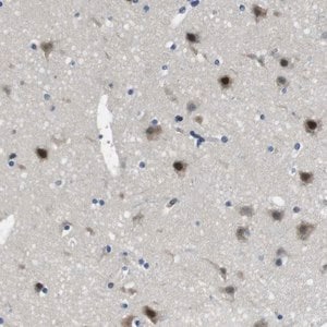 Merck Anti-LRRC49 antibody produced in rabbit