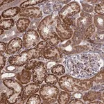 Merck Anti-PLEKHG2 antibody produced in rabbit