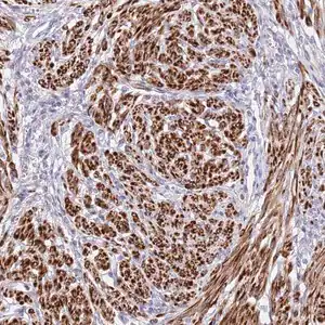 Merck Anti-NET1 antibody produced in rabbit