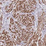 Merck Anti-NET1 antibody produced in rabbit