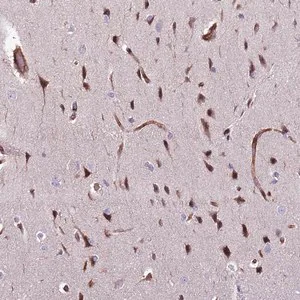 Merck Anti-ZNF827 antibody produced in rabbit