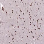 Merck Anti-ZNF827 antibody produced in rabbit