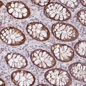 Merck Anti-ZNF791 antibody produced in rabbit