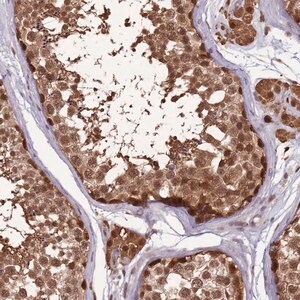 Merck Anti-ZBTB5 antibody produced in rabbit