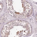 Merck Anti-SETX antibody produced in rabbit