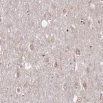 Merck Anti-TBC1D25 antibody produced in rabbit