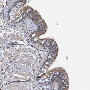 Merck Anti-CAPN13 antibody produced in rabbit