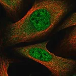 Merck Anti-GLMN antibody produced in rabbit