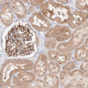 Merck Anti-GLMN antibody produced in rabbit