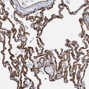 Merck Anti-EPS8L3 antibody produced in rabbit