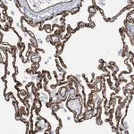 Merck Anti-EPS8L3 antibody produced in rabbit