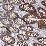 Merck Anti-HMGCS1 antibody produced in rabbit